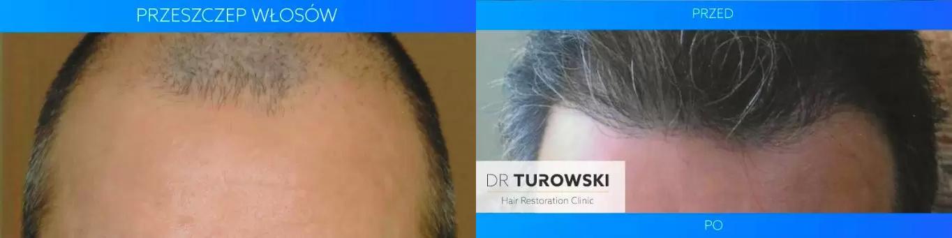 Dr Turowski Hair Restoration Clinic | Estheticon.com