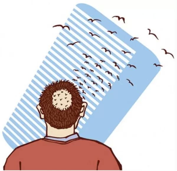 male pattern baldness