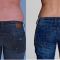 Tumescent liposuction