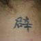 Tattoo removal