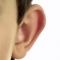 Ear surgery (Otoplasty)