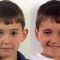Ear surgery (Otoplasty)
