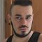 Hair Transplant