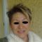 Eyelid surgery (Blepharoplasty)