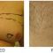 SlimLipo Laser Liposuction