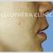 Lip augmentation - cheiloplasty